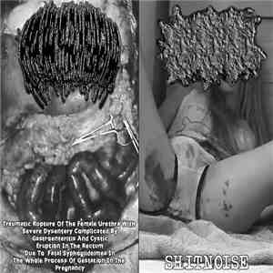 Hypoprothrombinemia, Anal Cake - Traumatic Rupture Of The Female Urethra Wi ...