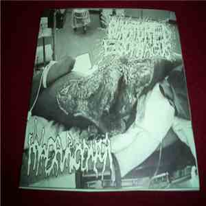 Punctured Esophagus / Hyperuricemia - Punctured Esophagus/Hyperuricemia