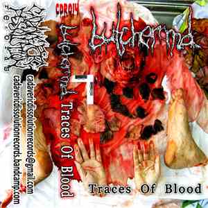 Butcher M.D. - Traces Of Blood Tape Version