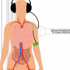 ignacioredard - A Love-Otomy