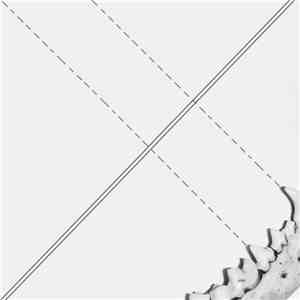 Linea Aspera - Linea Aspera