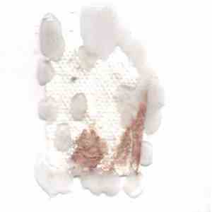 Sudden Infant - Blood Test Blood