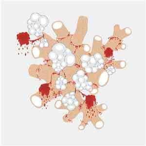 Saxon Shore - The Exquisite Death Of Saxon Shore