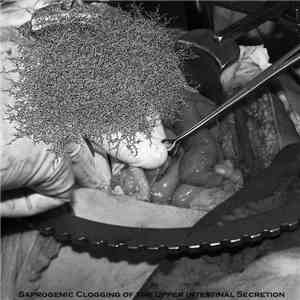 Necrotizing Intravenous Conditions - Saprogenic Clogging Of The Upper Inte ...