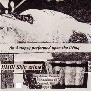 HMO / Skin Crime - An Autopsy Performed Upon The Living