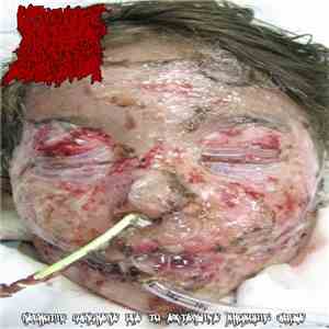 Ripping Off Your Herpe Scabs With A Power Sander - Necrotic Gangrene Due To ...